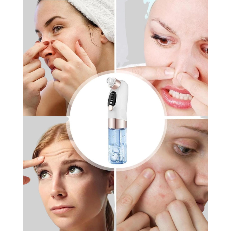 Elektrikli Siyah Nokta Sökücü  Derinlemesine Gözenek Temizleme Cihazı