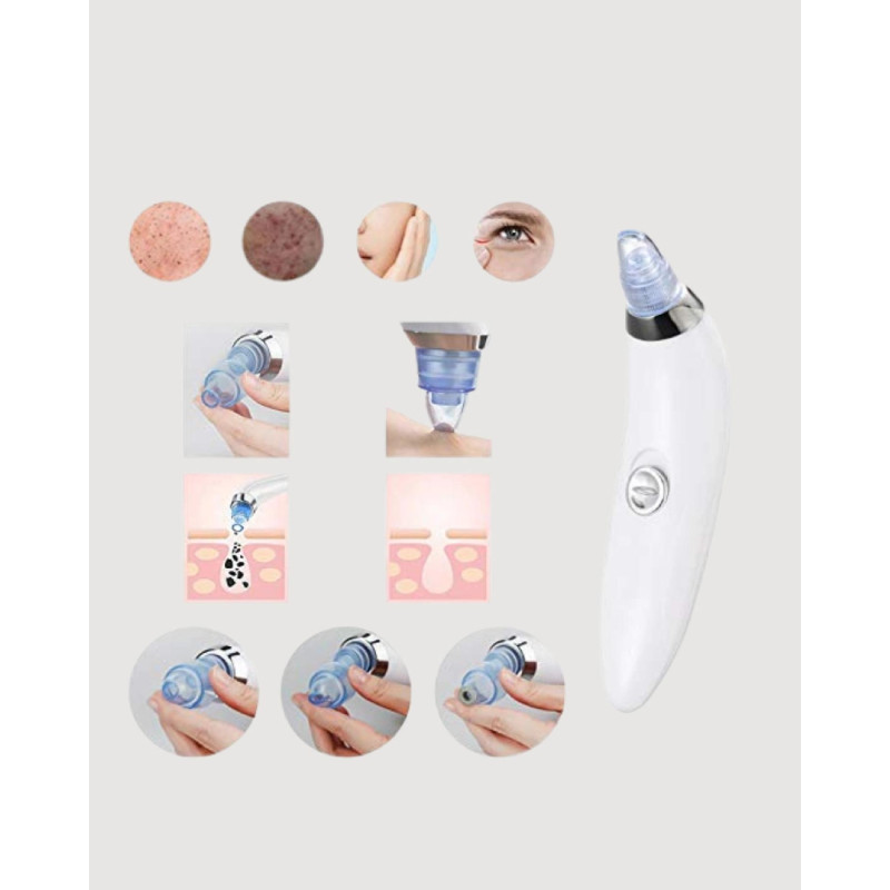 Güçlü Vakumlu Siyah Nokta Temizleyici  Cilt Pürüzlerini Gideren