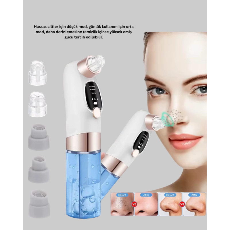 Ayarlanabilir Güç Seviyeli Vakumlu Siyah Nokta Temizleme Cihazı  Derin Gözenek Temizliği